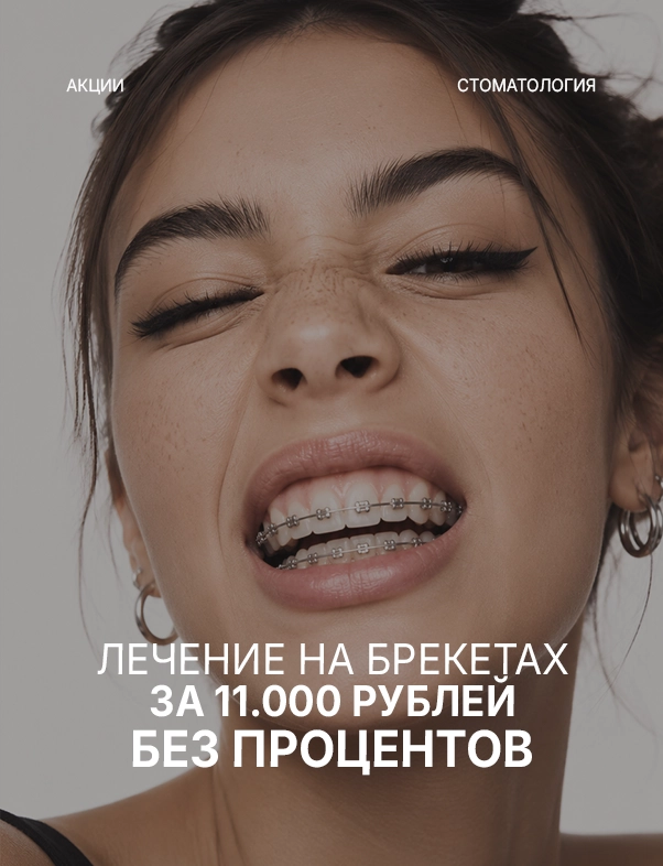 Беспроцентная рассрочка на ортодонтическое лечение