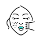 Угревая сыпь